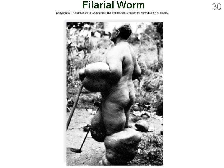 Filarial Worm 30 