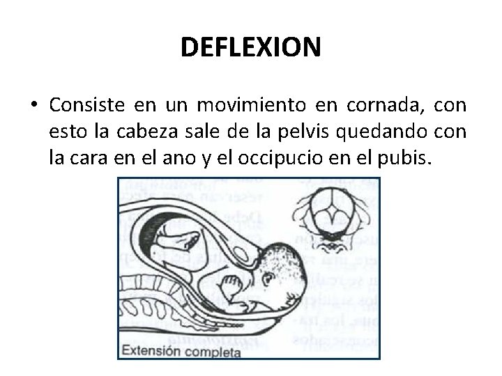 DEFLEXION • Consiste en un movimiento en cornada, con esto la cabeza sale de