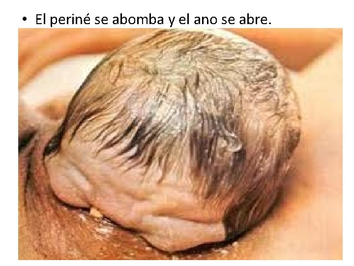  • El periné se abomba y el ano se abre. 