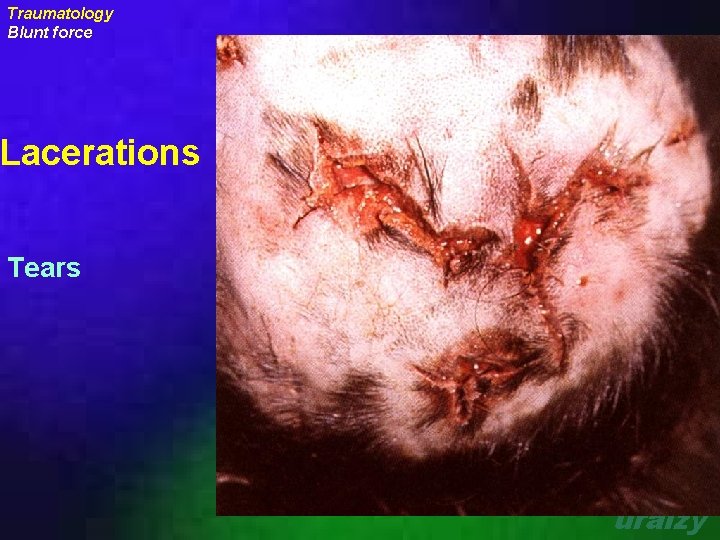 Traumatology Blunt force Lacerations Tears uraizy 