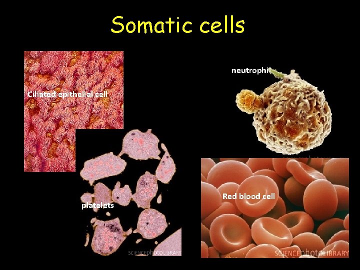 Somatic cells neutrophil Ciliated epithelial cell platelets Red blood cell 