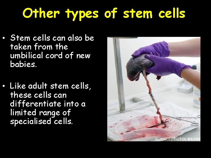 Other types of stem cells • Stem cells can also be taken from the