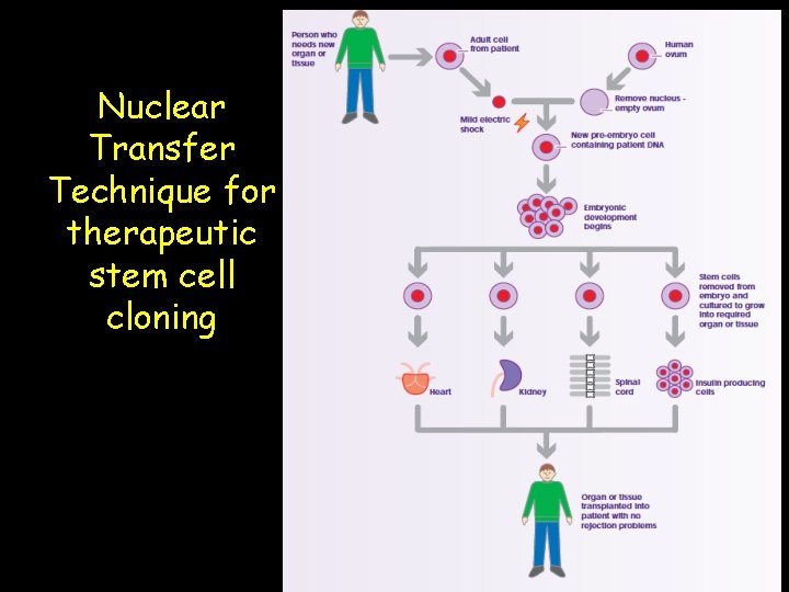 Nuclear Transfer Technique for therapeutic stem cell cloning 