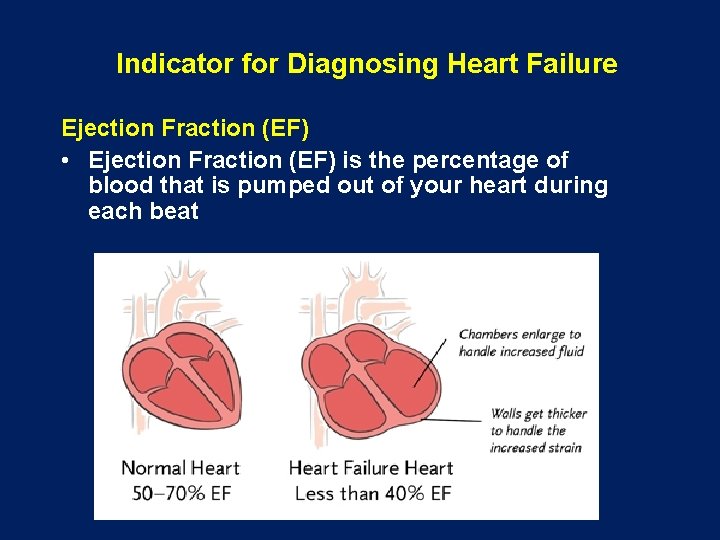  Indicator for Diagnosing Heart Failure Ejection Fraction (EF) • Ejection Fraction (EF) is