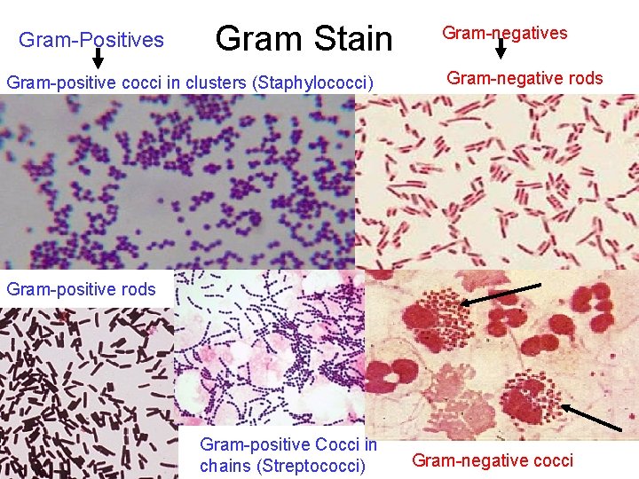 Gram-Positives Gram Stain Gram-positive cocci in clusters (Staphylococci) Gram-negatives Gram-negative rods Gram-positive Cocci in
