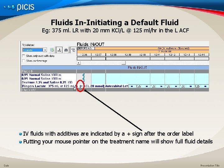 Fluids In-Initiating a Default Fluid Eg: 375 ml. LR with 20 mm KCl/L @