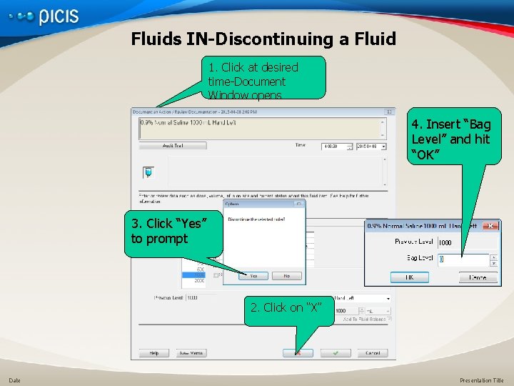 Fluids IN-Discontinuing a Fluid 1. Click at desired time-Document Window opens 4. Insert “Bag