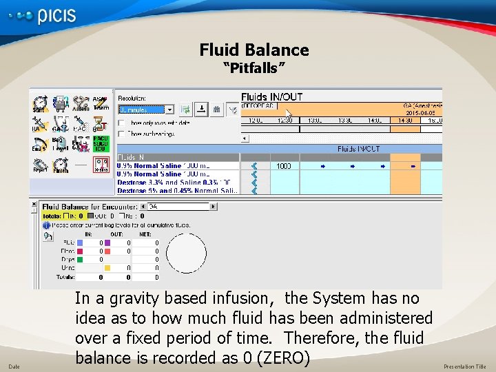 Fluid Balance “Pitfalls” Date In a gravity based infusion, the System has no idea