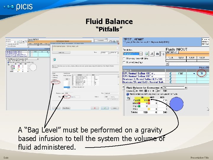 Fluid Balance “Pitfalls” A “Bag Level” must be performed on a gravity based infusion