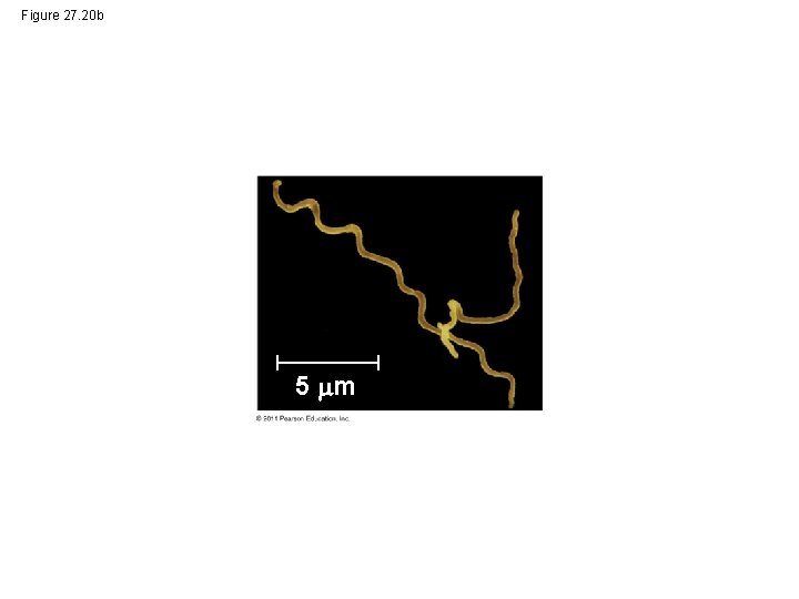 Figure 27. 20 b 5 m 