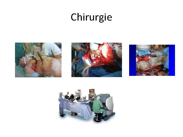 Chirurgie Chirurgie