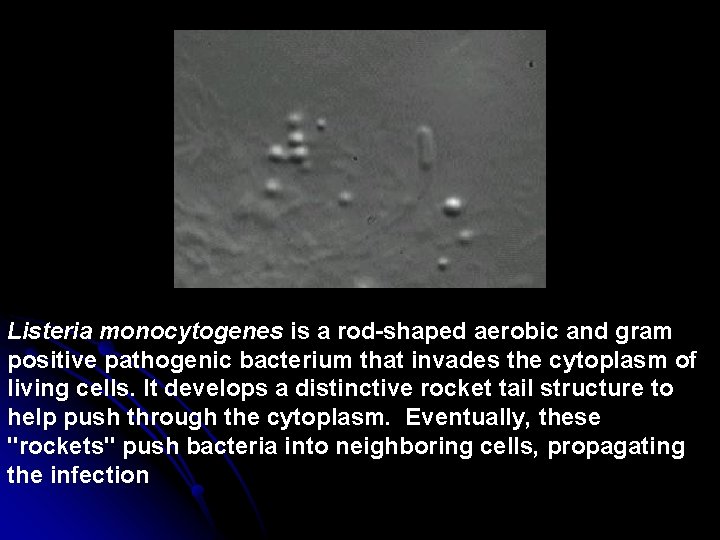 Listeria monocytogenes is a rod-shaped aerobic and gram positive pathogenic bacterium that invades the
