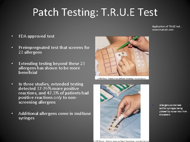 Patch Testing: T. R. U. E Test Application of TRUE test. www. truetest. com