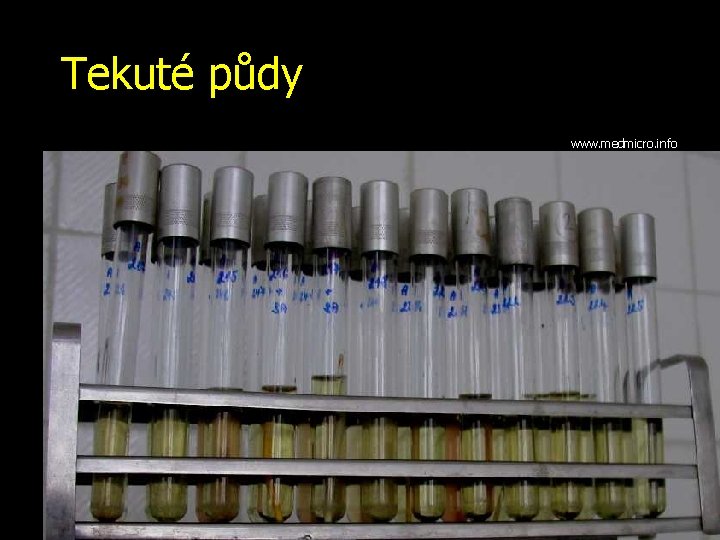 Tekuté půdy www. medmicro. info 