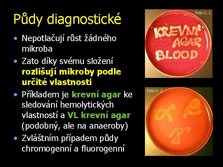 Půdy diagnostické • Nepotlačují růst žádného mikroba • Zato díky svému složení rozlišují mikroby