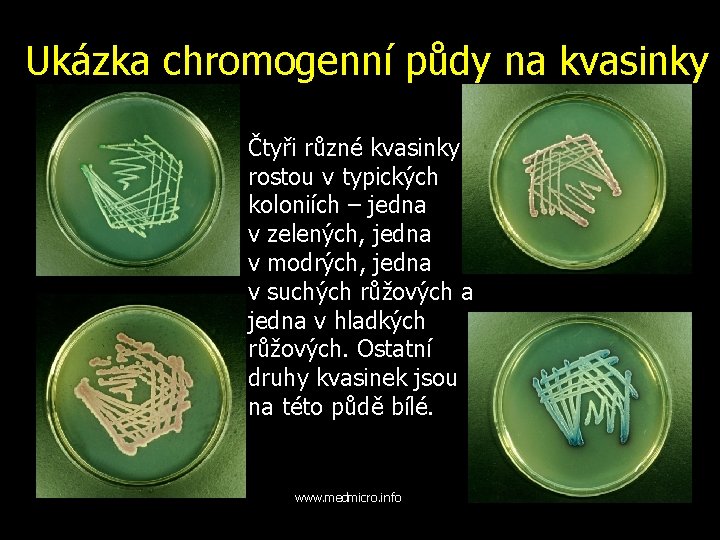 Ukázka chromogenní půdy na kvasinky Čtyři různé kvasinky rostou v typických koloniích – jedna