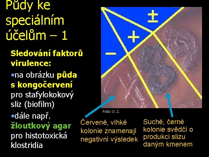 Půdy ke speciálním účelům – 1 Sledování faktorů virulence: • na obrázku půda s.