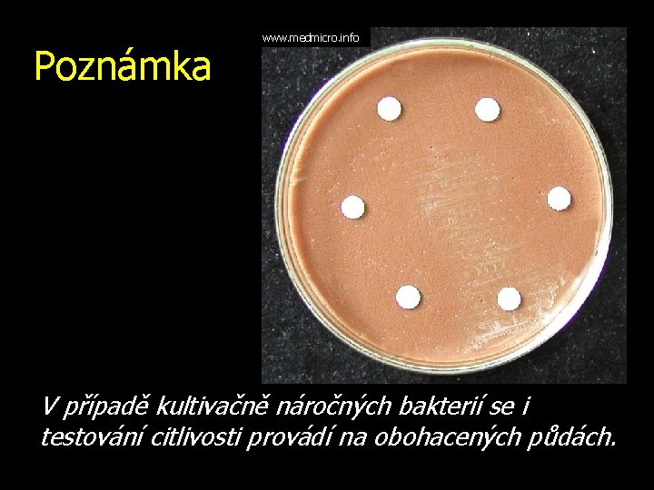 Poznámka www. medmicro. info V případě kultivačně náročných bakterií se i testování citlivosti provádí