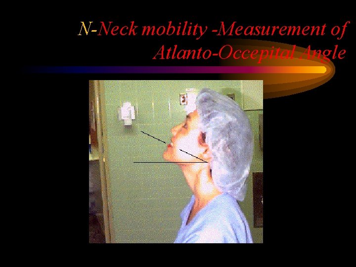 N-Neck mobility -Measurement of Atlanto-Occepital Angle 