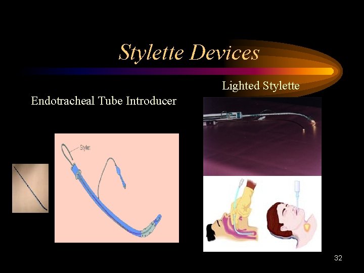 Stylette Devices Lighted Stylette Endotracheal Tube Introducer 32 