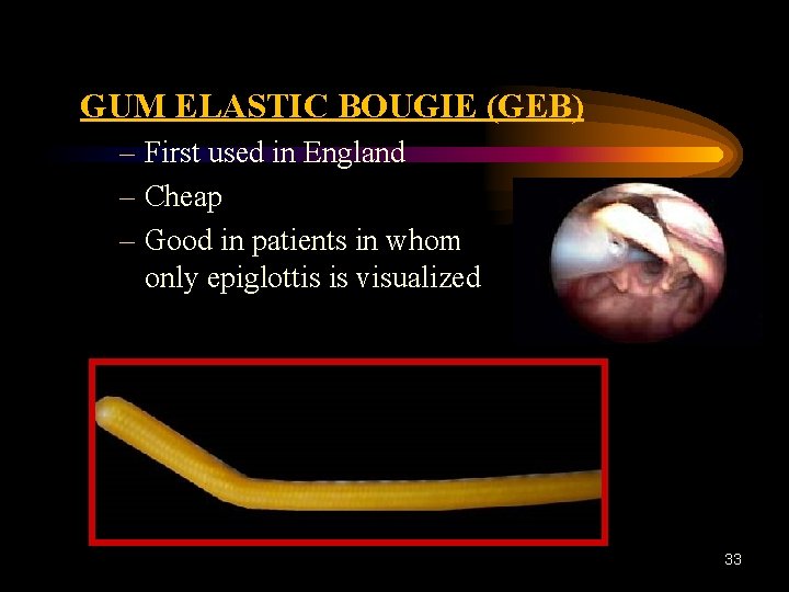 GUM ELASTIC BOUGIE (GEB) – First used in England – Cheap – Good in