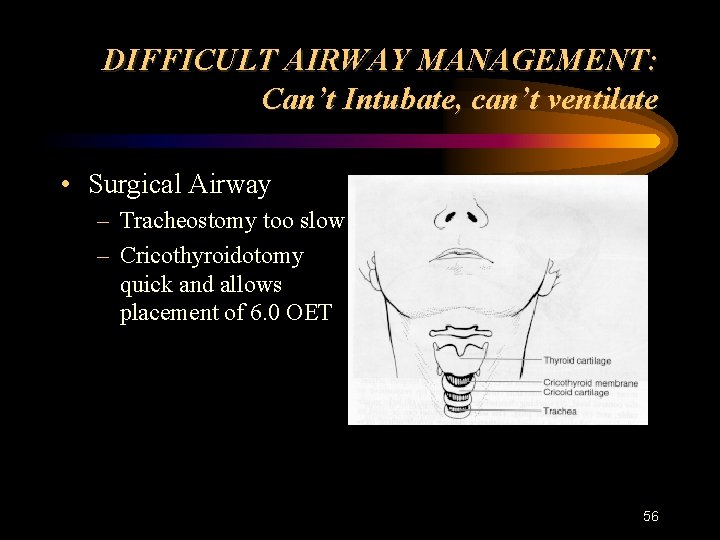 DIFFICULT AIRWAY MANAGEMENT: Can’t Intubate, can’t ventilate • Surgical Airway – Tracheostomy too slow