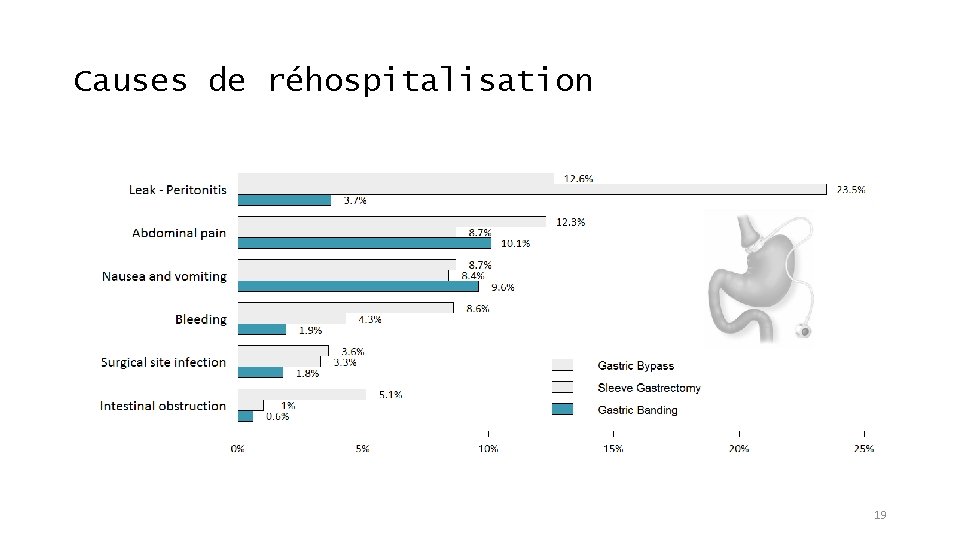 Causes de réhospitalisation 19 