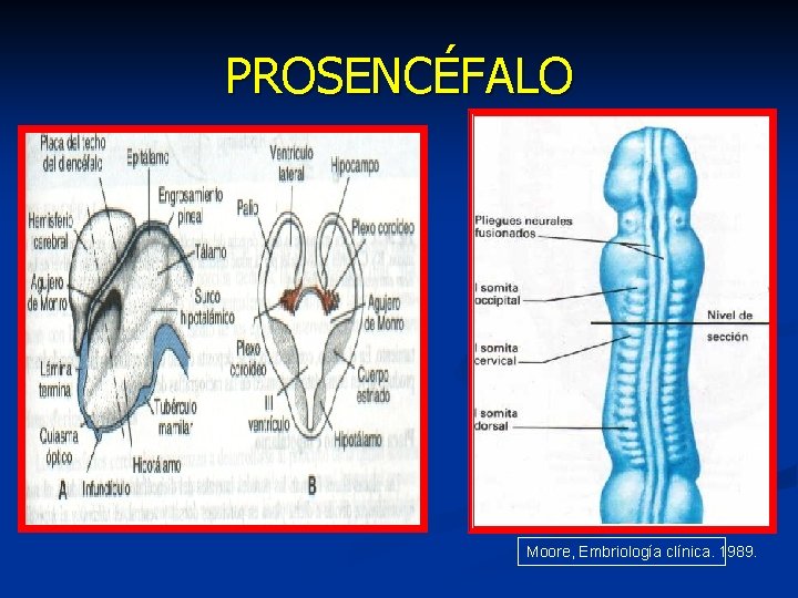 PROSENCÉFALO Moore, Embriología clínica. 1989. 