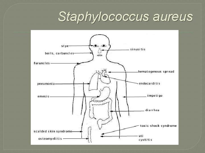 Staphylococcus aureus 