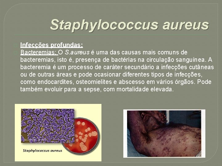 Staphylococcus aureus � � Infecções profundas: Bacteremias: O S. aureus é uma das causas