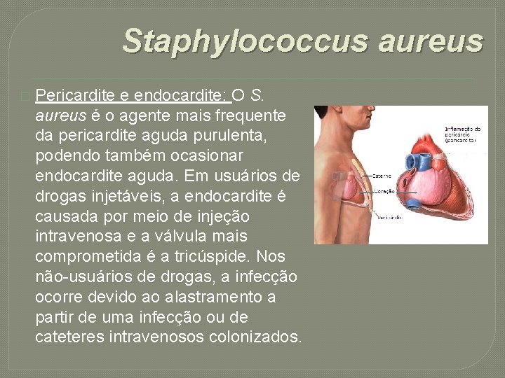 Staphylococcus aureus � Pericardite e endocardite: O S. aureus é o agente mais frequente