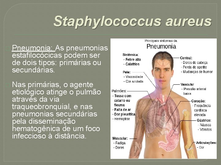 Staphylococcus aureus � Pneumonia: As pneumonias estafilocócicas podem ser de dois tipos: primárias ou