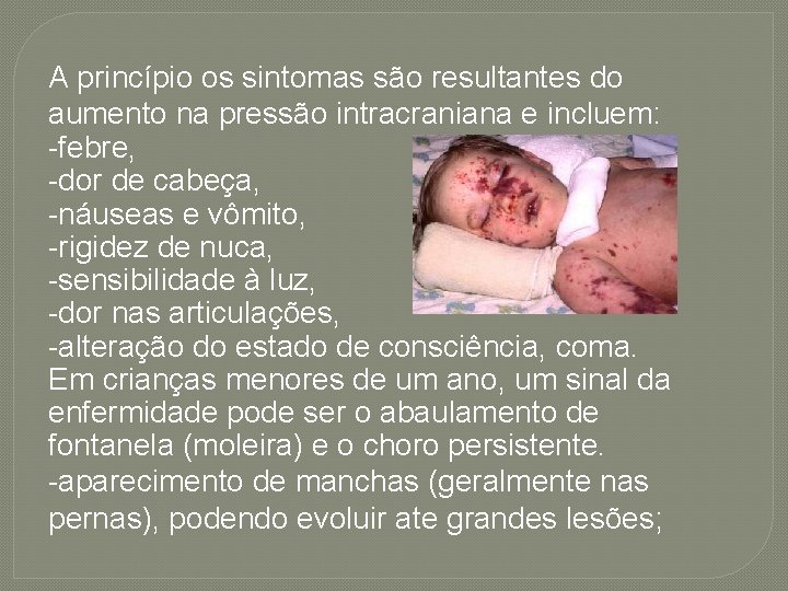 A princípio os sintomas são resultantes do aumento na pressão intracraniana e incluem: -febre,