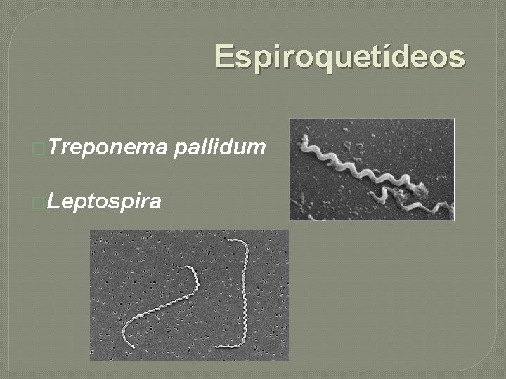 Espiroquetídeos �Treponema �Leptospira pallidum 