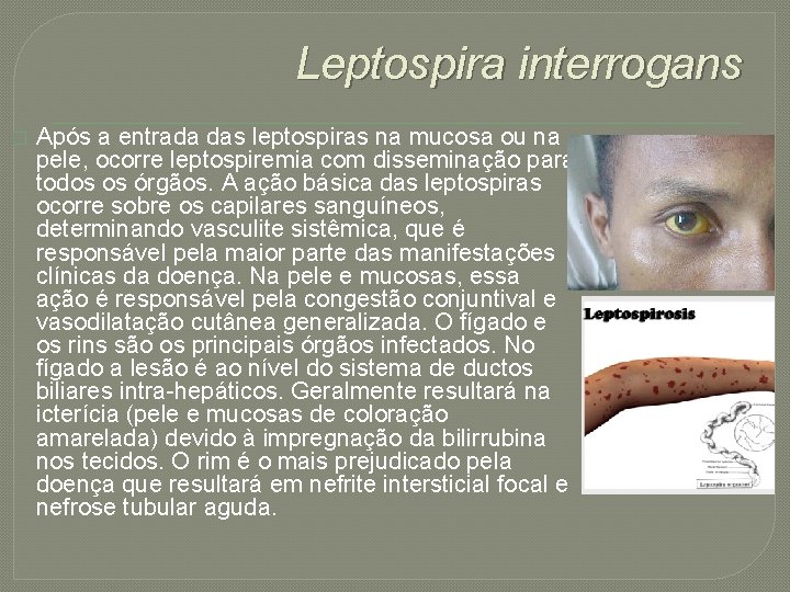 Leptospira interrogans � Após a entrada das leptospiras na mucosa ou na pele, ocorre