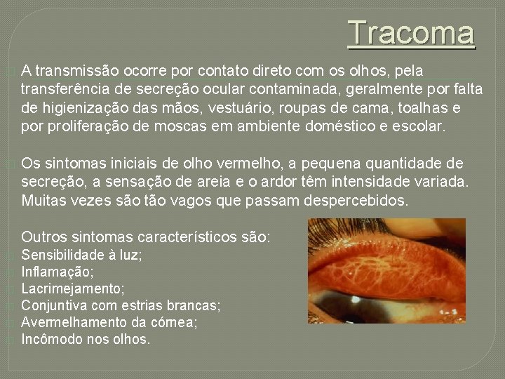 Tracoma � A transmissão ocorre por contato direto com os olhos, pela transferência de