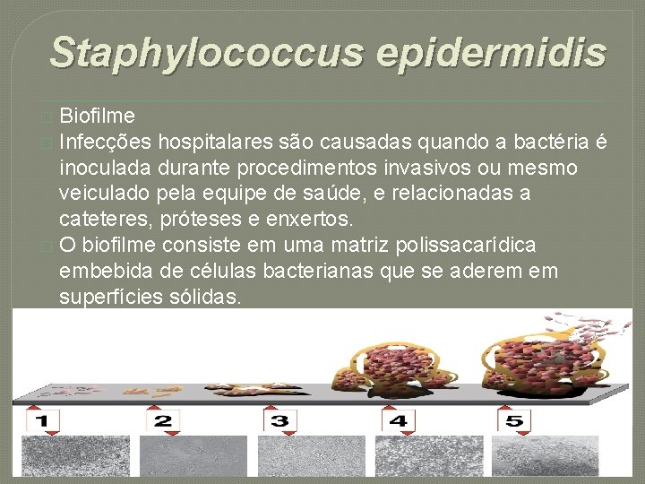 Staphylococcus epidermidis Biofilme � Infecções hospitalares são causadas quando a bactéria é inoculada durante