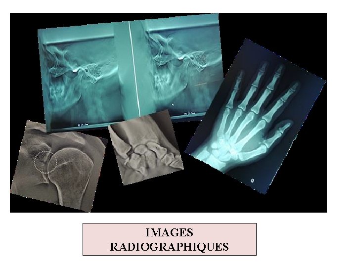 IMAGES RADIOGRAPHIQUES 