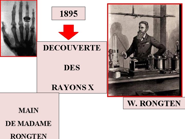 1895 DECOUVERTE DES RAYONS X MAIN DE MADAME RONGTEN W. RONGTEN 