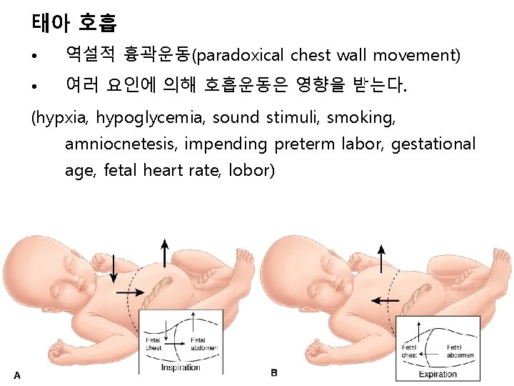 태아 호흡 • 역설적 흉곽운동(paradoxical chest wall movement) • 여러 요인에 의해 호흡운동은 영향을