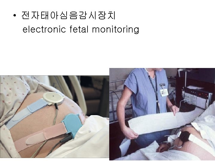  • 전자태아심음감시장치 electronic fetal monitoring 