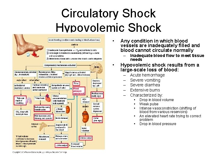 Circulatory Shock Hypovolemic Shock • Any condition in which blood vessels are inadequately filled