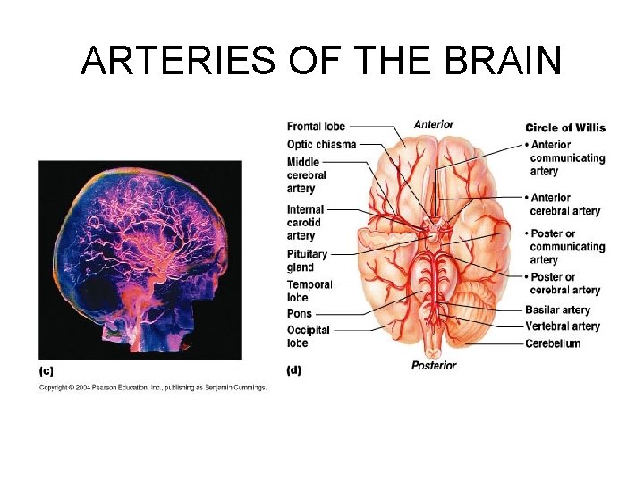 ARTERIES OF THE BRAIN 