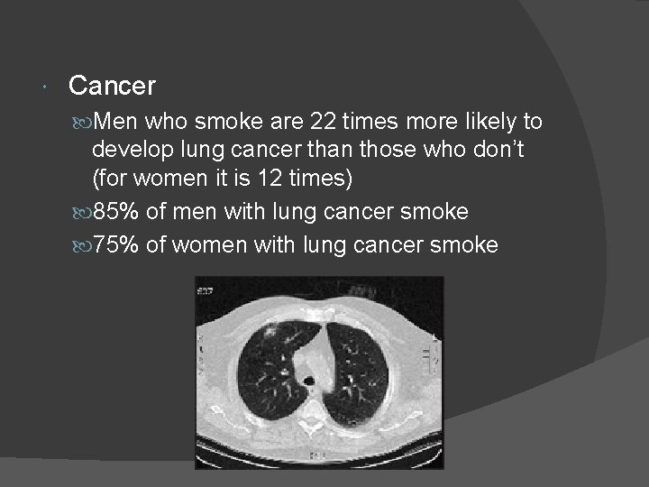  Cancer Men who smoke are 22 times more likely to develop lung cancer