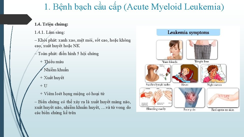 1. Bệnh bạch cầu cấp (Acute Myeloid Leukemia) 1. 4. Triệu chứng: 1. 4.