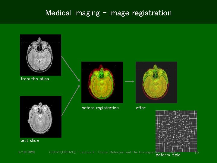 Medical imaging – image registration from the atlas before registration after test slice 9/10/2020