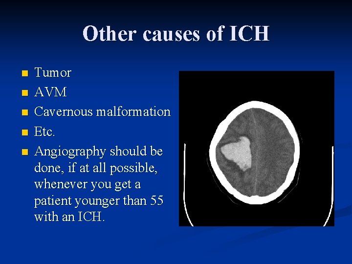 Other causes of ICH n n n Tumor AVM Cavernous malformation Etc. Angiography should