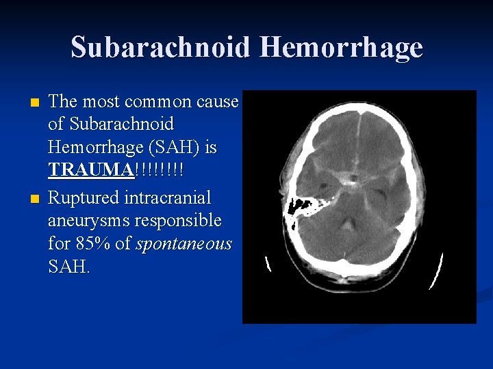 Subarachnoid Hemorrhage n n The most common cause of Subarachnoid Hemorrhage (SAH) is TRAUMA!!!!