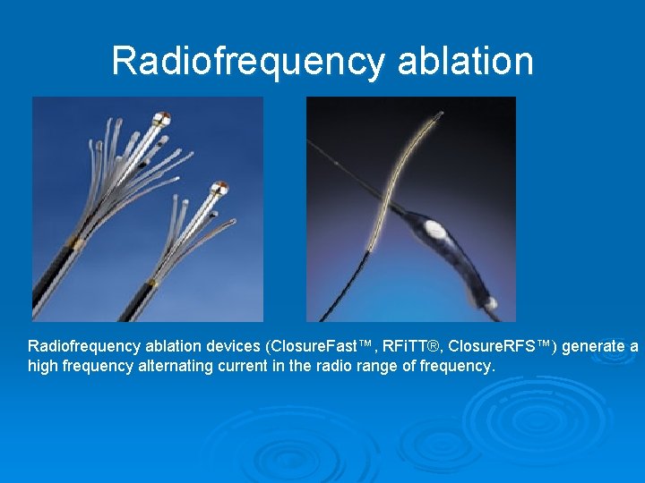 Radiofrequency ablation devices (Closure. Fast™, RFi. TT®, Closure. RFS™) generate a high frequency alternating