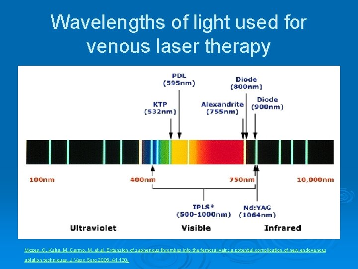 Wavelengths of light used for venous laser therapy Mozes, G, Kalra, M, Carmo, M,